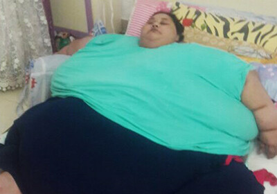 Самая тяжелая в мире женщина похудела на 100 килограммов за три недели