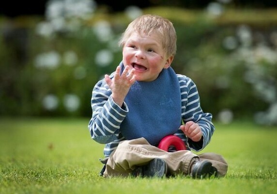 В Англии живет мальчик с хромосомной аномалией, которая встречается лишь у одного из 7 млрд человек (Фото)