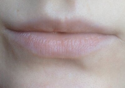 Медики рассказали, о чем свидетельствуют бледные губы