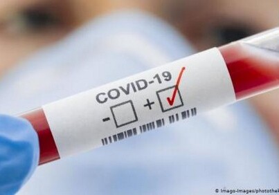 За сутки в Армении выявлено еще 355 инфицированных COVID-19