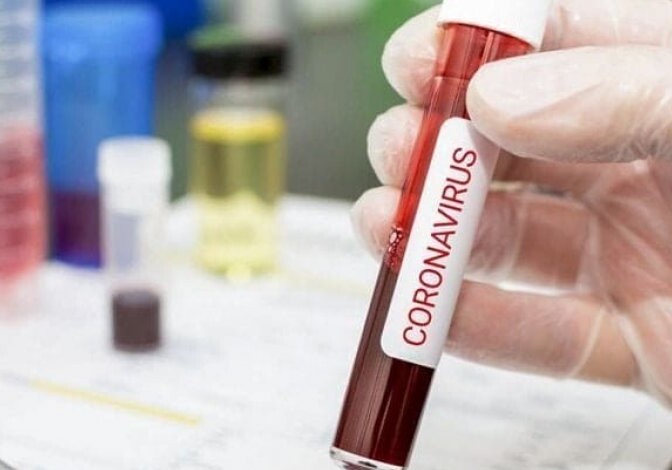 В Азербайджане выявлено еще 98 случаев заражения коронавирусом, 2 человека скончались