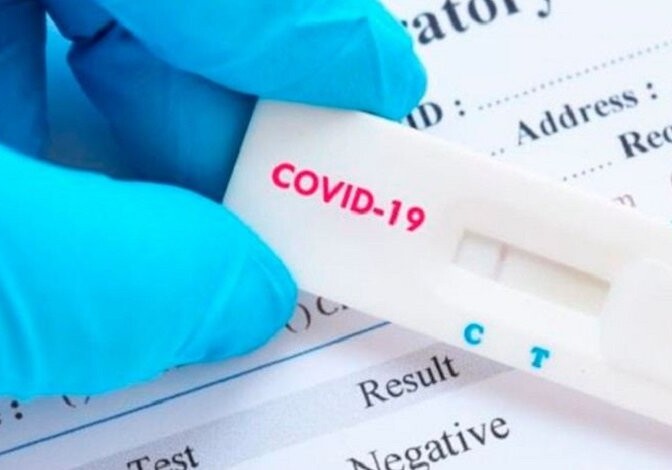В Азербайджане выявлено еще 3712 случаев заражения коронавирусом