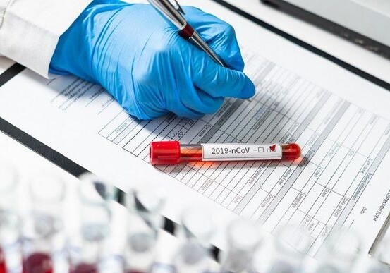 В Азербайджане выявлены 332 новых случая инфицирования коронавирусом