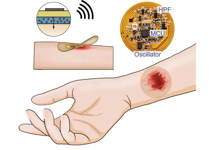 Создан «умный» пластырь, который лечит раны электричеством