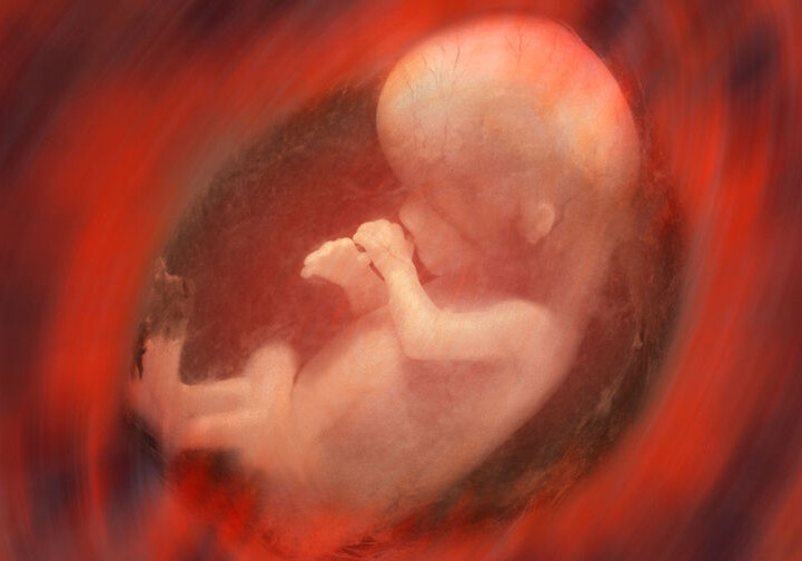 Индийские врачи извлекли восемь эмбрионов из брюшной полости младенца (Фото-Добавлено)