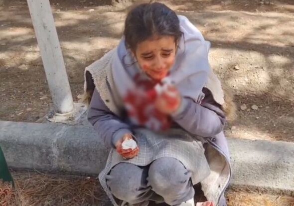 В Иране школьницу жестоко избили за неправильно завязанный платок (Видео)
