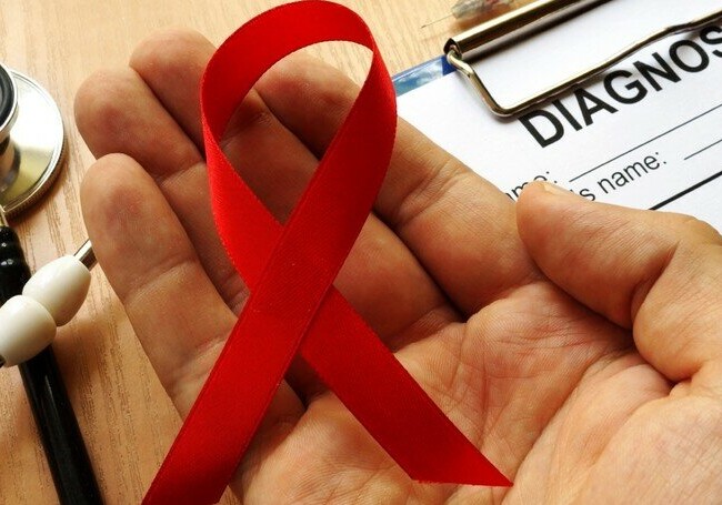 Сколько в Азербайджане зарегистрировано ВИЧ-инфицированных?