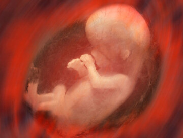 Индийские врачи извлекли восемь эмбрионов из брюшной полости младенца (Фото-Добавлено)